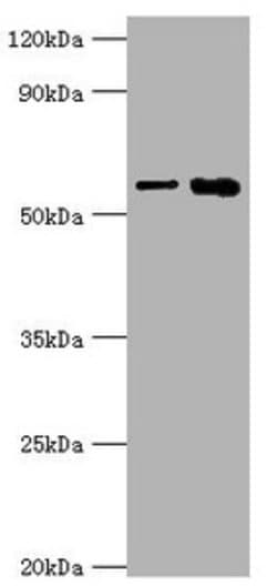 Invitrogen IL1R1 Polyclonal Antibody 100 &mu;L | Buy Online | Invitrogen&trade; | Fisher Scientific