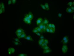 Invitrogen IL1RAPL1 Polyclonal Antibody 100 &mu;g; Unconjugated:Antibodies,