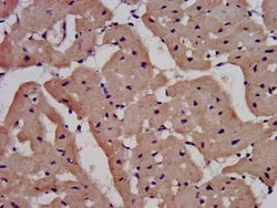 Invitrogen IL1RAPL1 Polyclonal Antibody 100 &mu;g; Unconjugated:Antibodies,