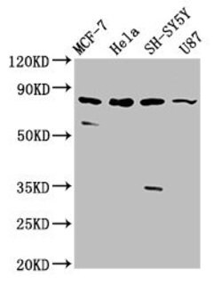 Invitrogen IL1RAPL1 Polyclonal Antibody 100 &mu;g; Unconjugated:Antibodies,