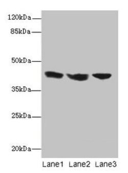 Invitrogen IL2RG Polyclonal Antibody 100 &mu;g; Unconjugated:Antibodies,