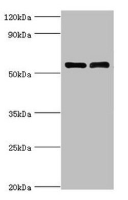 Invitrogen CD127 Polyclonal Antibody 100 &mu;L; Unconjugated:Antibodies,