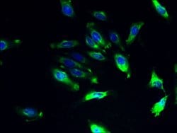 Invitrogen ILVBL Polyclonal Antibody 100 &mu;g; Unconjugated:Antibodies,