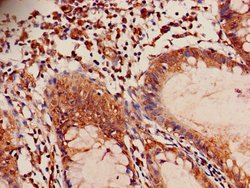 Invitrogen ILVBL Polyclonal Antibody 100 &mu;g; Unconjugated:Antibodies,