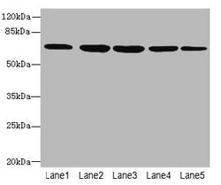 Invitrogen ILVBL Polyclonal Antibody 100 &mu;g; Unconjugated:Antibodies,