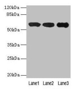Invitrogen IMPDH2 Polyclonal Antibody 100 &mu;g; Unconjugated:Antibodies,