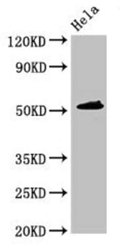 Invitrogen IP6K1 Polyclonal Antibody 100 &mu;g; Unconjugated:Antibodies,