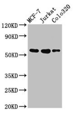 Invitrogen IRX4 Polyclonal Antibody 100 &mu;g | Buy Online | Invitrogen&trade; | Fisher Scientific