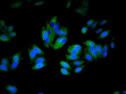 Invitrogen CD11a Polyclonal Antibody 100 &mu;g; Unconjugated:Antibodies,
