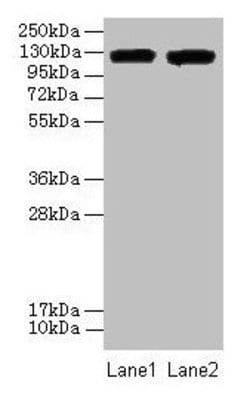 Invitrogen CD11a Polyclonal Antibody 100 &mu;g; Unconjugated:Antibodies,