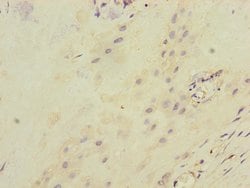 Invitrogen ITGB8 Polyclonal Antibody 100 &mu;L; Unconjugated:Antibodies,