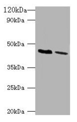 Invitrogen Kir1.1 (KCNJ1) Polyclonal Antibody 100 &mu;g; Unconjugated:Antibodies,