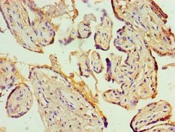 Invitrogen KCNN4 Polyclonal Antibody 100 &mu;L | Buy Online | Invitrogen&trade; | Fisher Scientific