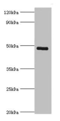 Invitrogen KCNN4 Polyclonal Antibody 100 &mu;L | Buy Online | Invitrogen&trade; | Fisher Scientific