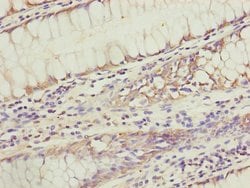 Invitrogen KIAA0391 Polyclonal Antibody 100 &mu;L; Unconjugated:Antibodies,