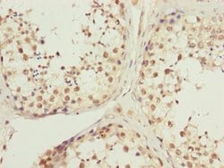 Invitrogen KIAA0391 Polyclonal Antibody 100 &mu;L; Unconjugated:Antibodies,