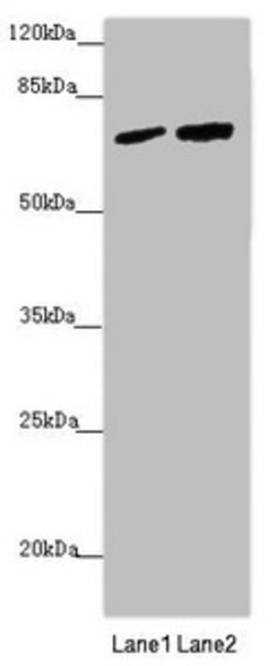 Invitrogen KIAA0391 Polyclonal Antibody 100 &mu;L; Unconjugated:Antibodies,