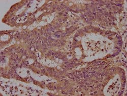 LCHN Polyclonal Antibody:Antibodies, Polyclonal