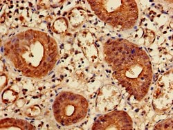 Invitrogen KIDINS220 Polyclonal Antibody 100 &mu;g; Unconjugated:Antibodies,