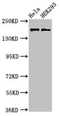 Invitrogen KIDINS220 Polyclonal Antibody 100 &mu;g; Unconjugated:Antibodies,