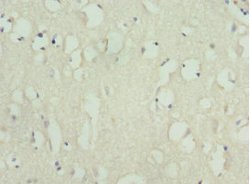 Invitrogen KIF3A Polyclonal Antibody 100 &mu;L; Unconjugated:Antibodies,