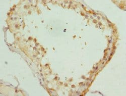 Invitrogen KIF3A Polyclonal Antibody 100 &mu;L; Unconjugated:Antibodies,