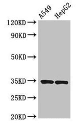 Invitrogen NKG2D Polyclonal Antibody 100 &mu;L; Unconjugated:Antibodies,