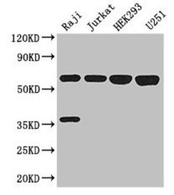 Invitrogen KPNA2 Polyclonal Antibody 100 &mu;g; Unconjugated:Antibodies,