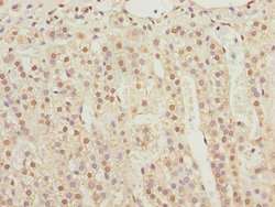 Invitrogen KPNA6 Polyclonal Antibody 100 &mu;L; Unconjugated:Antibodies,
