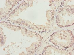Invitrogen KPNA6 Polyclonal Antibody 100 &mu;L; Unconjugated:Antibodies,