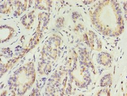Invitrogen Cytokeratin 10 Polyclonal Antibody 100 &mu;g; Unconjugated:Antibodies,