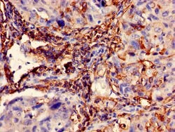 Invitrogen Cytokeratin 10 Polyclonal Antibody 100 &mu;g; Unconjugated:Antibodies,