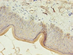 Invitrogen Cytokeratin 10 Polyclonal Antibody 100 &mu;g; Unconjugated:Antibodies,