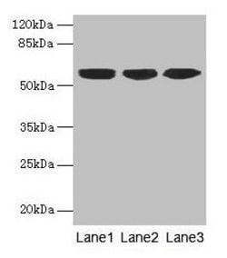 Invitrogen Cytokeratin 10 Polyclonal Antibody 100 &mu;g; Unconjugated:Antibodies,
