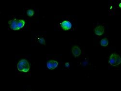 Invitrogen Cytokeratin 16 Polyclonal Antibody 100 &mu;g; Unconjugated:Antibodies,