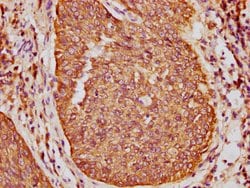Invitrogen Cytokeratin 16 Polyclonal Antibody 100 &mu;g; Unconjugated:Antibodies,
