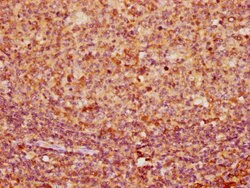 Invitrogen Cytokeratin 16 Polyclonal Antibody 100 &mu;g; Unconjugated:Antibodies,