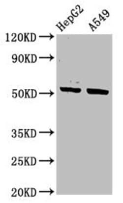 Invitrogen Cytokeratin 16 Polyclonal Antibody 100 &mu;g; Unconjugated:Antibodies,