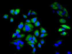 Invitrogen Cytokeratin 6A Polyclonal Antibody 100 &mu;g; Unconjugated:Antibodies,