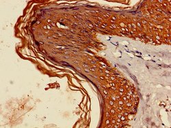 Invitrogen Cytokeratin 6A Polyclonal Antibody 100 &mu;g; Unconjugated:Antibodies,