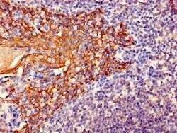 Invitrogen Cytokeratin 6A Polyclonal Antibody 100 &mu;g; Unconjugated:Antibodies,