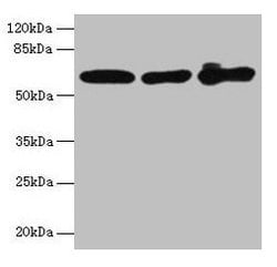 Invitrogen Cytokeratin 6A Polyclonal Antibody 100 &mu;g; Unconjugated:Antibodies,