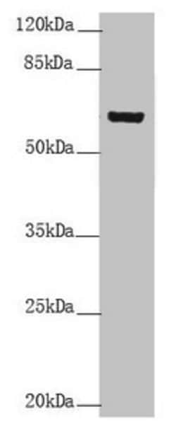 Invitrogen Cytokeratin 6B Polyclonal Antibody 100 &mu;L; Unconjugated:Antibodies,