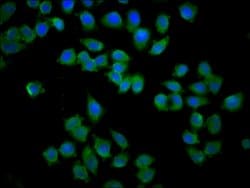Invitrogen KY Polyclonal Antibody 100 &mu;g; Unconjugated:Antibodies, Polyclonal