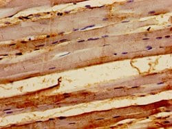 Invitrogen KY Polyclonal Antibody 100 &mu;g; Unconjugated:Antibodies, Polyclonal