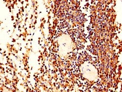 Invitrogen L-Plastin Polyclonal Antibody 100 &mu;g; Unconjugated:Antibodies,