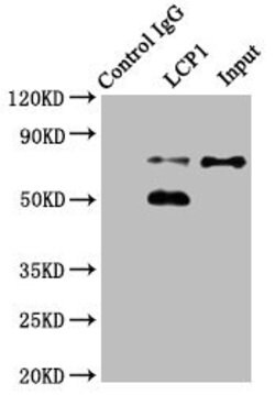 Invitrogen L-Plastin Polyclonal Antibody 100 &mu;g; Unconjugated:Antibodies,