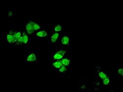 Invitrogen DYNLL1 Polyclonal Antibody 100 &mu;g; Unconjugated:Antibodies,