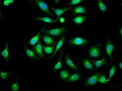 Invitrogen Galectin 1 Polyclonal Antibody 100 &mu;g; Unconjugated:Antibodies,