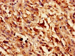 Invitrogen Galectin 1 Polyclonal Antibody 100 &mu;g; Unconjugated:Antibodies,